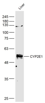 CYP2E1 Rabbit Polyclonal Antibody