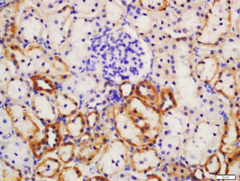 CYP2E1 Rabbit Polyclonal Antibody