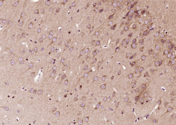FGF20 Rabbit Polyclonal Antibody