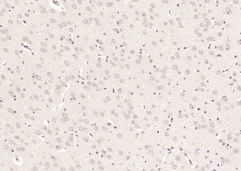 ASAP3 Rabbit Polyclonal Antibody