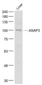ASAP3 Rabbit Polyclonal Antibody