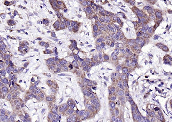 CTHRC1 Rabbit Polyclonal Antibody