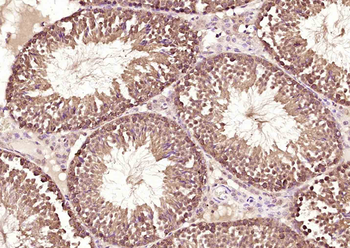 RBM3 Rabbit Polyclonal Antibody