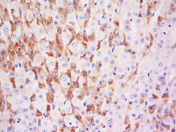 ADM Rabbit Polyclonal Antibody