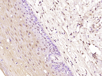 BRCAA1 Rabbit Polyclonal Antibody