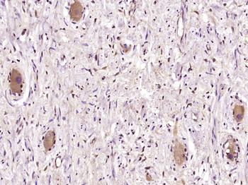 BRCAA1 Rabbit Polyclonal Antibody