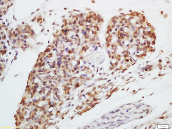 HSP40 Rabbit Polyclonal Antibody