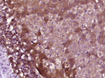 PAMP/ADM Rabbit Polyclonal Antibody