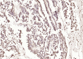 ST5 Rabbit Polyclonal Antibody