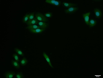 HES1 Rabbit Polyclonal Antibody