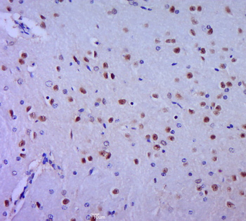 HES1 Rabbit Polyclonal Antibody