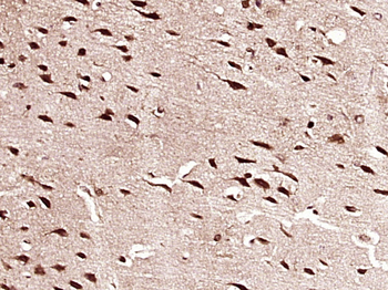 HES1 Rabbit Polyclonal Antibody