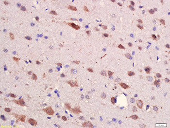 HES1 Rabbit Polyclonal Antibody