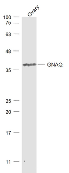 GNAQ Rabbit Polyclonal Antibody