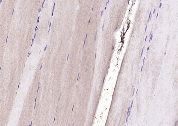 HOMER2 Rabbit Polyclonal Antibody