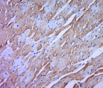 HOMER2 Rabbit Polyclonal Antibody