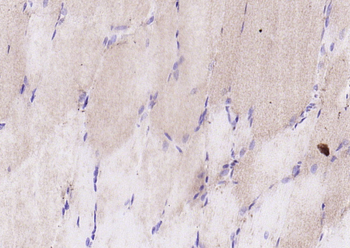 HOMER2 Rabbit Polyclonal Antibody