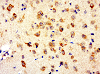 Adenosine A3 Receptor Rabbit Polyclonal Antibody