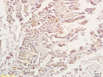 Adenosine A3 Receptor Rabbit Polyclonal Antibody