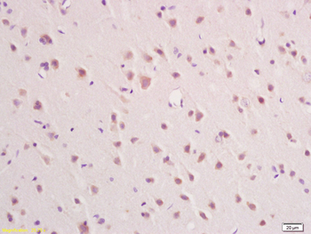 IFNAR2 Rabbit Polyclonal Antibody