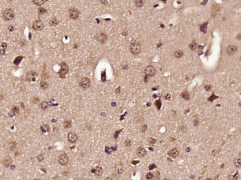 ELOVL2 Rabbit Polyclonal Antibody