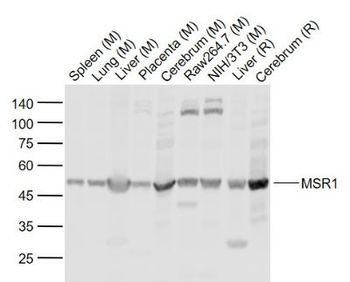 MSR1 Rabbit Polyclonal Antibody