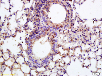 APPD Rabbit Polyclonal Antibody