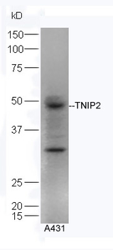 TNIP2 Rabbit Polyclonal Antibody