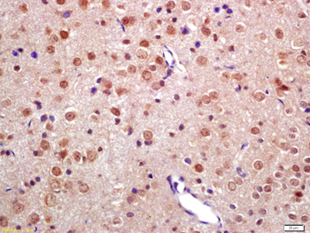 TNIP2 Rabbit Polyclonal Antibody