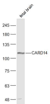 CARD14 Rabbit Polyclonal Antibody