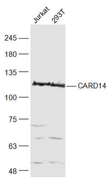 CARD14 Rabbit Polyclonal Antibody