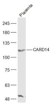 CARD14 Rabbit Polyclonal Antibody