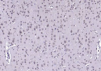 AEBP1 Rabbit Polyclonal Antibody