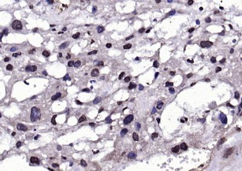 AEBP1 Rabbit Polyclonal Antibody