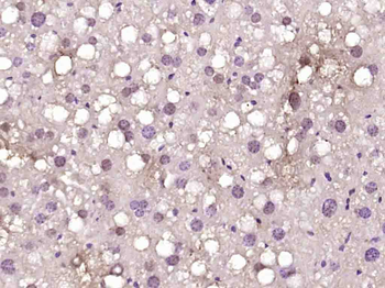 A1CF Rabbit Polyclonal Antibody