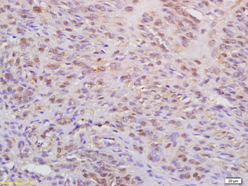 WAPL Rabbit Polyclonal Antibody