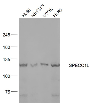 SPECC1L Rabbit Polyclonal Antibody