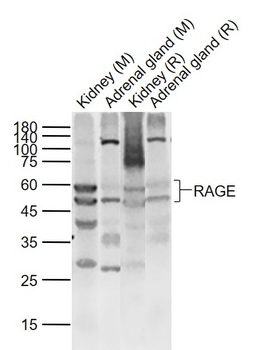 RAGE Rabbit Polyclonal Antibody