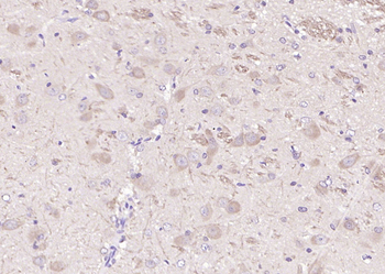 VHL Rabbit Polyclonal Antibody