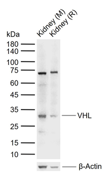 VHL Rabbit Polyclonal Antibody