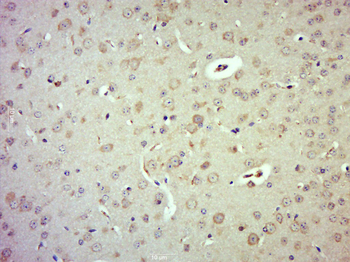 Phospho-LATS1+LATS2 (Thr1079 +Thr1041) Rabbit Polyclonal Antibody