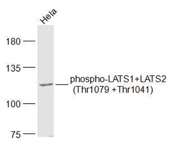 Phospho-LATS1+LATS2 (Thr1079 +Thr1041) Rabbit Polyclonal Antibody