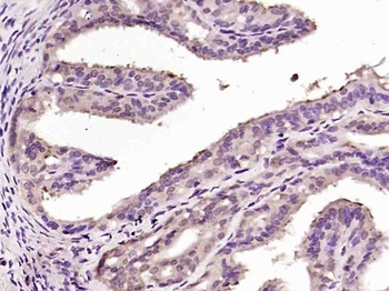 OSGIN1 Rabbit Polyclonal Antibody