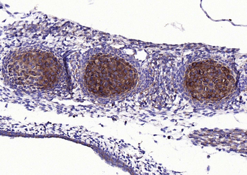 ACAN Rabbit Polyclonal Antibody