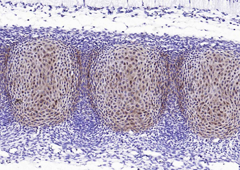 ACAN Rabbit Polyclonal Antibody