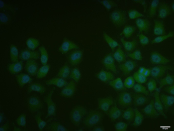 SMAD1 + SMAD5 Rabbit Polyclonal Antibody