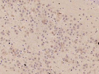 TNFAIP5 Rabbit Polyclonal Antibody
