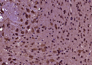 PRODH Rabbit Polyclonal Antibody