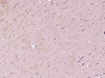 TBC1D4 Rabbit Polyclonal Antibody
