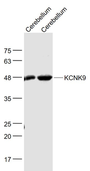 KCNK9 Rabbit Polyclonal Antibody
